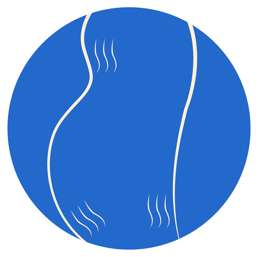 Stretch Marks